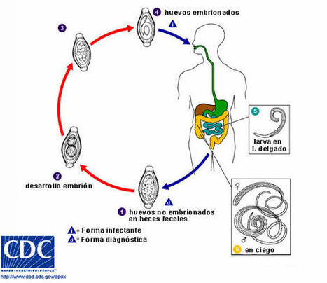 ASCARIS LUMBRICOIDES Y TRICHURIS TRICHIURA | Tr...