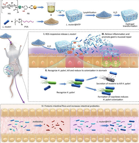 Hydrogel-Transformable Probiotic Powder for Targeted Eradication of Helicobacter pylori with Enhanced Gastric Mucosal Repair and Microbiota Preservation | AdvS | RMH | Scoop.it