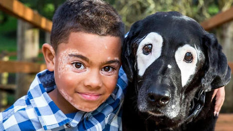 Mejores amigos: La emotiva historia de un niño con vitíligo y su perro con la misma enfermedad | Personas y Animales | Scoop.it