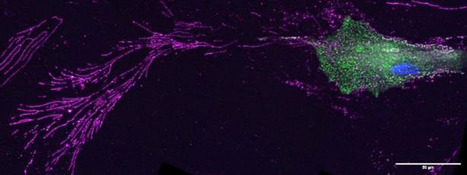 Les fibroblastes génèrent des chemins de membrane pour orienter la migration des cellules tumorales | Life Sciences Université Paris-Saclay | Scoop.it