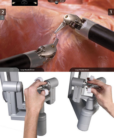 Rush to Robotic Surgery Outpaces Medical Evidence, Critics Say | Managed Care Magazine Online | ROBOTIC SURGERY | Scoop.it