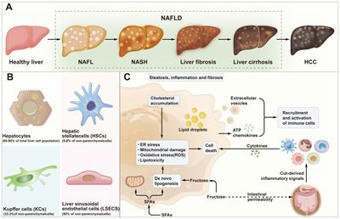 Frontiers | Immunomodulation in non-alcoholic fatty liver disease: exploring mechanisms and applications | AUTOIMMUNITY | Scoop.it