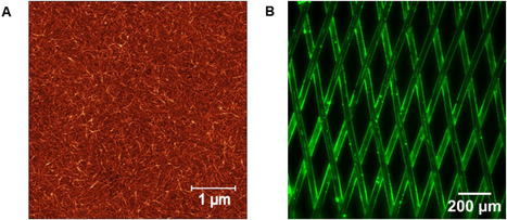 Flow diverter surface modifications for aneurysm treatment: A review of the mechanisms and data behind existing technologies | Neurovascular Intervention | Scoop.it