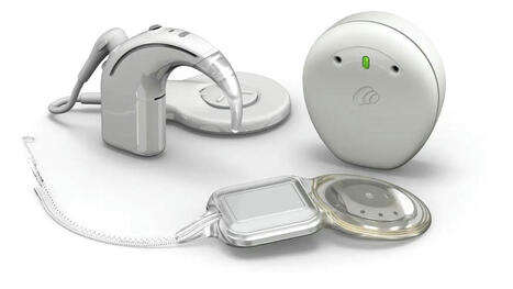 Cochlear lance Nucleus Nexa, un système d’implant cochléaire « intelligent » | Revue de presse Implant Cochléaire | Scoop.it