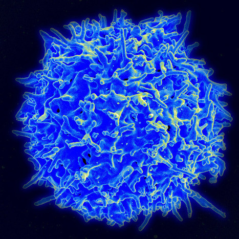 Risk of secondary cancers after CAR-T cell therapy low, according to large study | Healthcare: reloaded... | Scoop.it