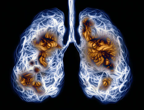 COVID-19 and Flu-Ravaged Lungs Could Be Repaired with mRNA Therapy | Virus World | Scoop.it