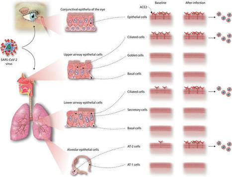 Inhalation therapies for COVID-19 | Mucosal Immunity | Scoop.it