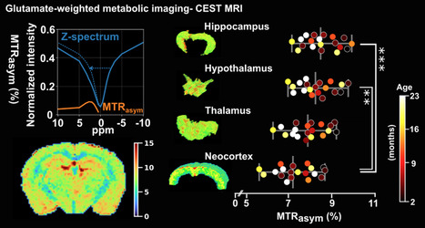 A novel MR-based glutamate-weighted brain atlas of the mouse during aging at ultra-high magnetic field | Life Sciences Universit&eacute; Paris-Saclay | Scoop.it