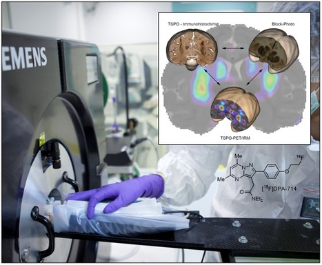 Le plateau d’imagerie TEP de MIRCen : au cœur du développement de biomarqueurs de maladies neurodégénératives ! | Life Sciences Université Paris-Saclay | Scoop.it