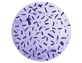 Vaccines and therapies against botulism | VaccineOrb | Elsevier | Immunology and Biotherapies | Scoop.it