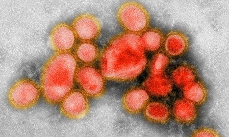 "Controversial scientist recreates H1N1 flu that killed 500K people" - NOT | Virology News | Scoop.it