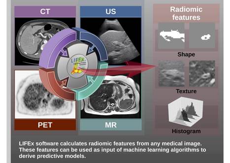 LIFEx: a freeware for radiomic feature calculation in multimodality imaging to accelerate advances in the characterization of tumor heterogeneity | Life Sciences Université Paris-Saclay | Scoop.it