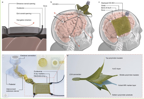 Wire guide-driven brain-computer interface: minimally invasive implanted with high-density electrode array, and the auditory decoding accuracy rate exceeds 80% | Brain Computer Interfaces & connected medical devices | Scoop.it
