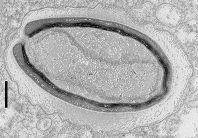 Pandoravirus : des virus géants qui inventent leurs propres gènes | Life Sciences Université Paris-Saclay | Scoop.it