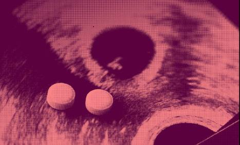 T&eacute;moignage Mon IVG, mon choix : &laquo;Ces deux avortements, &ccedil;a m&rsquo;a sauv&eacute; la vie&raquo; | Famille et sexualit&eacute; | Scoop.it