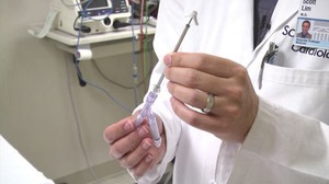 UVA Offering New Heart Valve Repair Procedure - NBC 29 News | Transcatheter Treatment of Mitral Regurgitation | Scoop.it