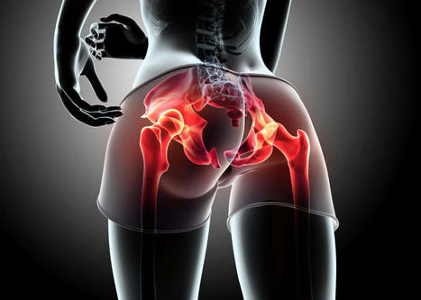 Piriformis Syndrome May Cause More Than Hip Pain | Call: 915-850-0900 | Spine Health & Spinal Hygiene | Scoop.it