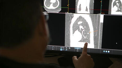 L&rsquo;environnement de travail est-il sous-estim&eacute; dans l&rsquo;apparition des cancers&nbsp;? | France Info | Pr&eacute;vention du risque chimique | Scoop.it