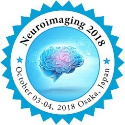3rd International Conference on Neuroscience, Neuroradiology & Imaging  | Medical Events and Conferences | Scoop.it