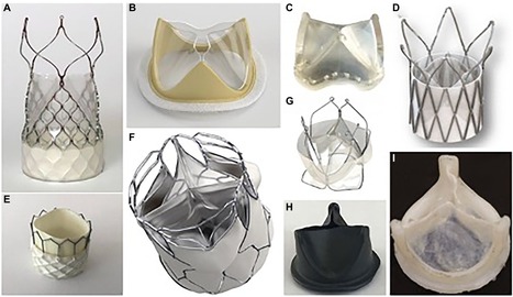 Frontiers | Polymeric prosthetic heart valves: A review of current technologies and future directions | Transcatheter Treatment of Mitral Regurgitation | Scoop.it