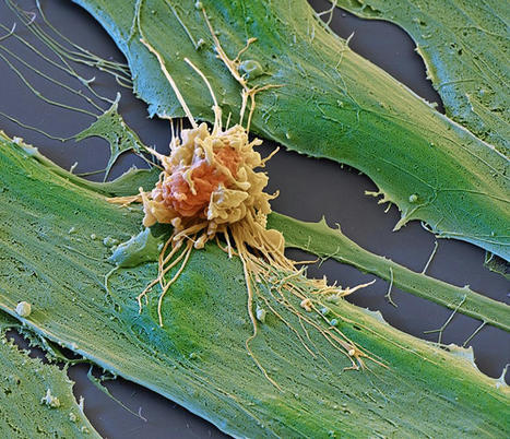 Cancer treatments boosted by immune-cell hacking | Amazing Science | Scoop.it
