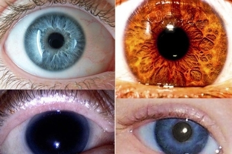 Ojos de colores más raros en seres humanos | Salud Visual 2.0 | Scoop.it