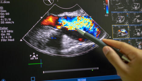 Researchers issue warning after discovering alarming link to heart disease: 'Cause around one in five ... deaths' - The Cool Down | Operation Deimos | Scoop.it