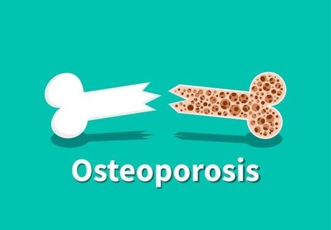 CPD course on osteoporosis | CME-CPD | Scoop.it