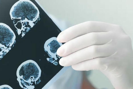 Bayer s'appuie sur Google Cloud pour développer des applications d'IA en radiologie | Digital Pharma news | Scoop.it