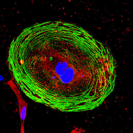 Featured Photo: hiPSC-Derived Cardiomyocytes | iBB | Scoop.it