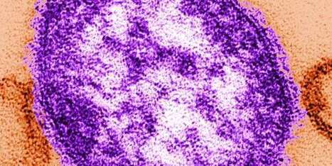 Le nombre de cas de rougeole atteint un record en Europe | Sant&eacute;, m&eacute;decine, sexualit&eacute; et culture g&eacute;n&eacute;rale | Scoop.it