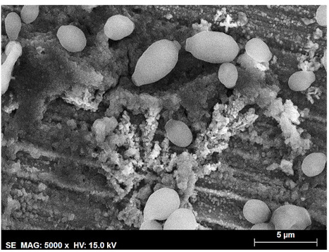 Anti-Candida spp. Activity of Zn Coated with ZnO-nanostructured Flowers | iBB | Scoop.it