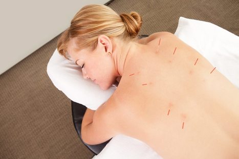More evidence that acupuncture doesn’t work for chronic pain – Science-Based Medicine | Escepticismo y pensamiento crítico | Scoop.it