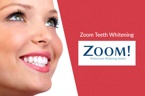 Fast and effective teeth whitening services in London | Dental Tips 