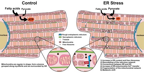 Le stress RE induit une dysfonction cardiaque via une modification de l'architecture et une altération de la fonction mitochondriale du cardiomyocyte | Life Sciences Université Paris-Saclay | Scoop.it