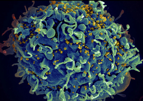 Early antiretroviral treatment may preserve key CD8-cell immune responses to HIV -  Ragon Institute study finds  | Virus World | Scoop.it