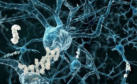 This New Breakthough Alzheimer’s Treatment Fully Restores Memory Function | Health Supreme | Scoop.it