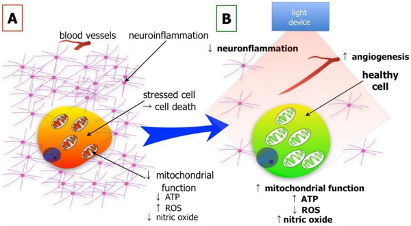 Lights-on for Cardiovascular Disease: Can Red and Near Infrared Light Treatment Help the Recovery Process?&nbsp; | Interventional Cardiology | Scoop.it