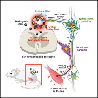 Multiple Sclerosis Research: Theory How Cells enter the Brain | NeuroImmunology | Scoop.it