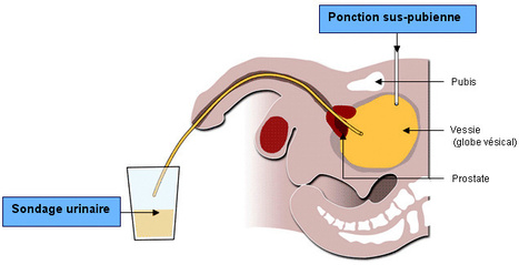 Pourquoi les sondages d'opinion ont-ils de moins en moins fiables ? - Express [FR] | Chronique des Droits de l'Homme | Scoop.it