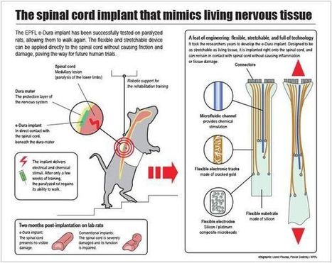 How electronic tissue could help paralyzed people walk again | Social Media, Internet, Content, Curation | Scoop.it