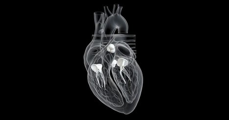 Atrium-affixed TMVR system safe, improves 1-year outcomes | Transcatheter Treatment of Mitral Regurgitation | Scoop.it