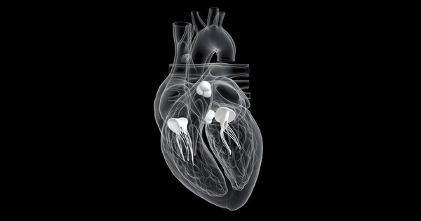 Atrium-affixed TMVR system safe, improves 1-year outcomes | Transcatheter Treatment of Mitral Regurgitation | Scoop.it