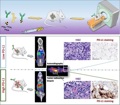 FOCUS PLATEFORME : L’immunoTEP : une immunohistochimie corps entier in vivo pour un nouvel éclairage sur les thérapies ciblées | Life Sciences Université Paris-Saclay | Scoop.it