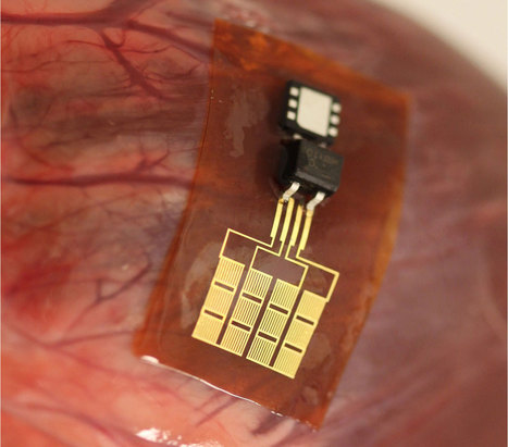 Nanoribbons let beating hearts power their own pacemakers | Daily Magazine | Scoop.it