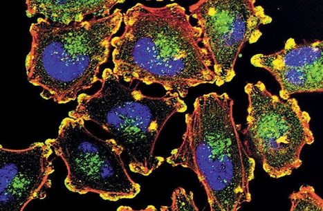 Une nouvelle voie pour moduler la r&eacute;ponse immunitaire anti-tumorale | Life Sciences Universit&eacute; Paris-Saclay | Scoop.it
