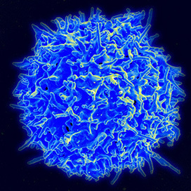 Catalyzing Progress in Cancer Immunotherapy | Immunology and Biotherapies | Scoop.it