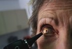 Los casos de glaucoma en EE. UU. aumentan un 22 por ciento en una década, según un informe | Salud Visual 2.0 | Scoop.it