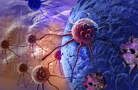 Nouvelles pistes thérapeutiques pour améliorer le traitement du cancer de l’ovaire | RééDOC  - IRR Nancy : Actualités en Médecine Physique et de Réadaptation (MPR) - UGECAM Nord-Est | Scoop.it