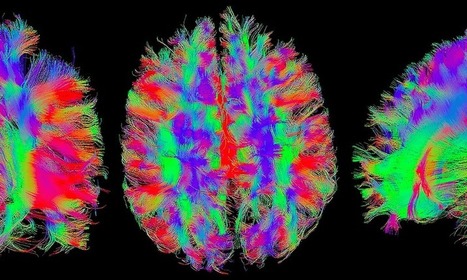 Excesiva conectividad entre dos redes cerebrales se asocia con la ira y la agresión | Educación, TIC y ecología | Scoop.it